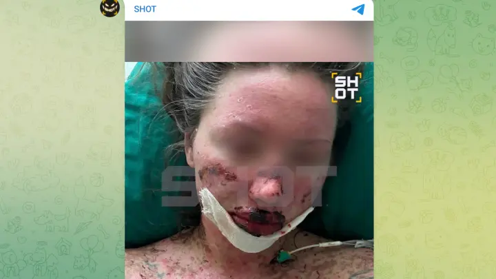 Москвичка едва не умерла из-за таблеток от депрессии