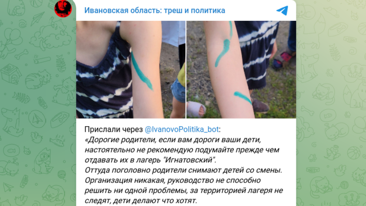 Полиция Ивановской области выехала в детский лагерь разбирать конфликт между девочками 8 и 10 лет