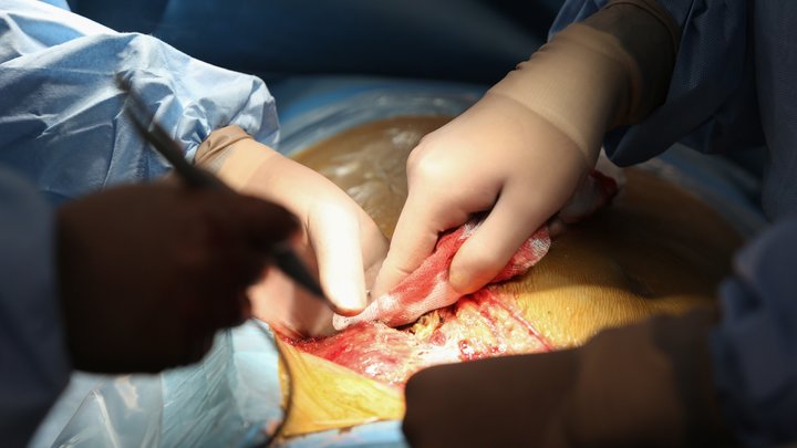 Наноробот за 1,5 тысячи рублей: Российские учёные научили машину находить и убивать раковые клетки