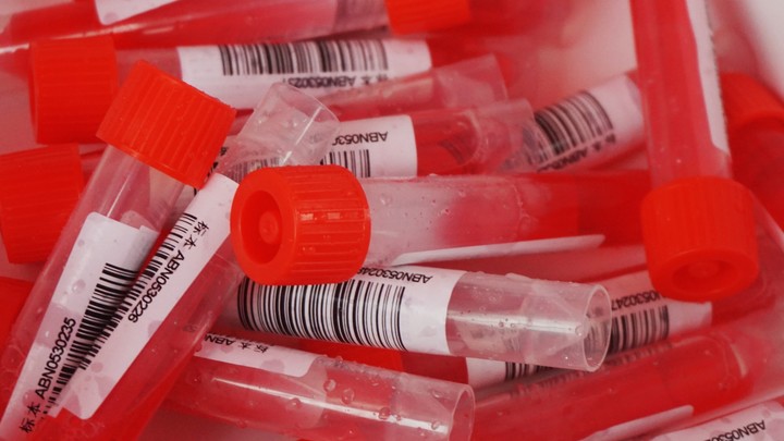 Онколог назвал способ вовремя выявить рак кишечника: Семь тревожных признаков