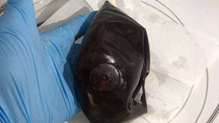 В Новороссийске женщина едва не умерла в погоне за похудением