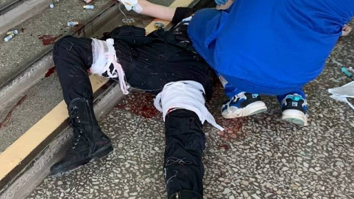 Опубликовано первое фото из больницы: убийца 6 человек в пермском университете пришёл в себя