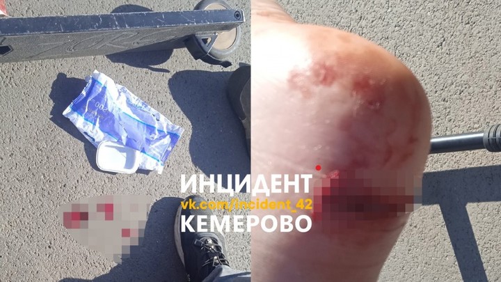 В Кемерове электросамокатчик сбил 11-летнего мальчика и уехал