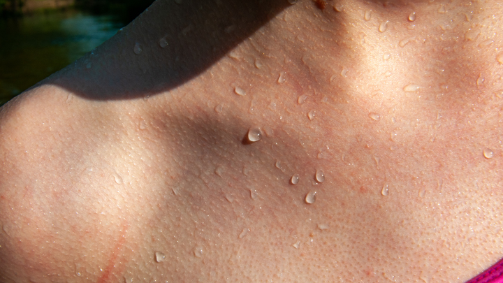 Пять заболеваний можно выявить по состоянию кожи