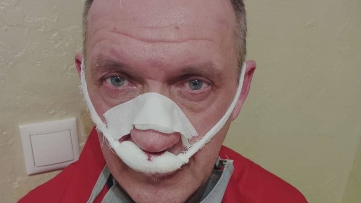 В Краснодаре задержали мужчину, ударившего медработника скорой помощи