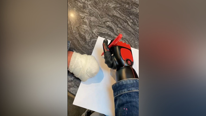 Фигурист Роман Костомаров написал первое слово с помощью протеза руки