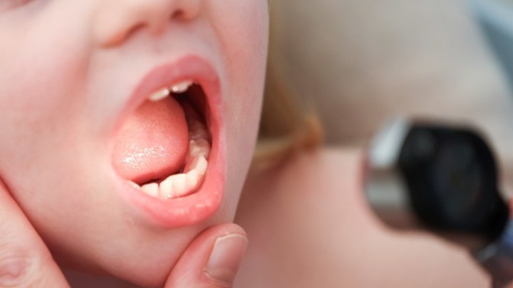 Врач Уланкина назвала главные отличия ОРВИ, гриппа и коронавируса