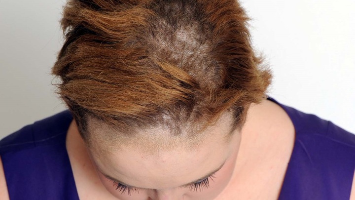 Сухие шампуни массово отзывают из-за опасного вещества