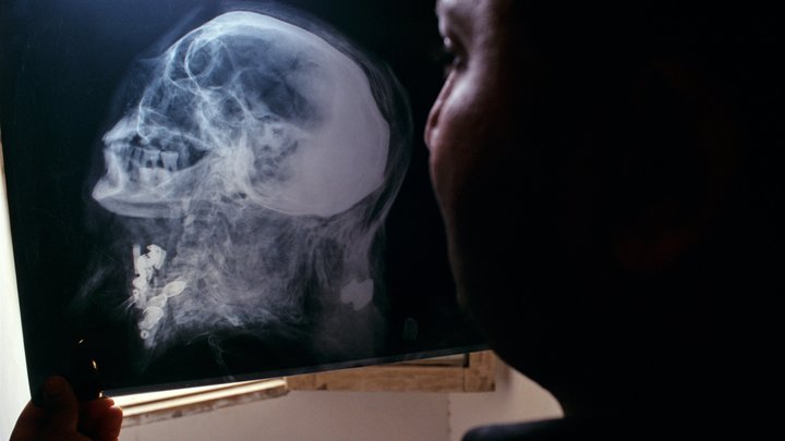 Тайна столетней мумии сбила учёных с толку: Открыла глаза и свела с ума очевидца