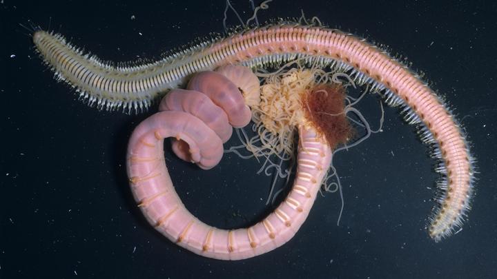 Врачи не видели такого ни разу в жизни. История с 12-сантиметровым червём прогремела на всю Россию