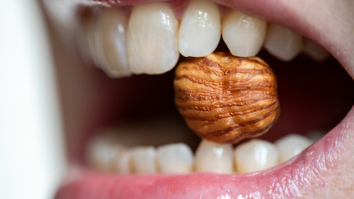 Воспаления дёсен могут указать на рак: Учёные рассказали о связи заболеваний