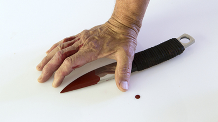 Прокуратура начала проверку после поножовщины между детьми в школе в Мытищах