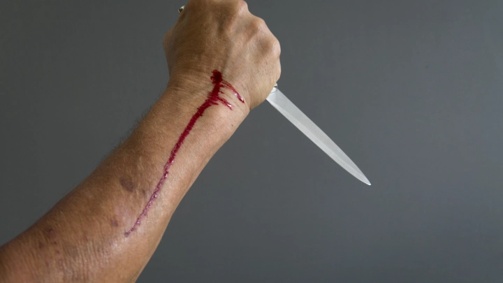 В Махачкале мужчина нанёс себе увечья у дверей отделения банка