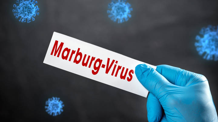 Спасения почти нет: Первые симптомы вируса Марбург. Как лечить