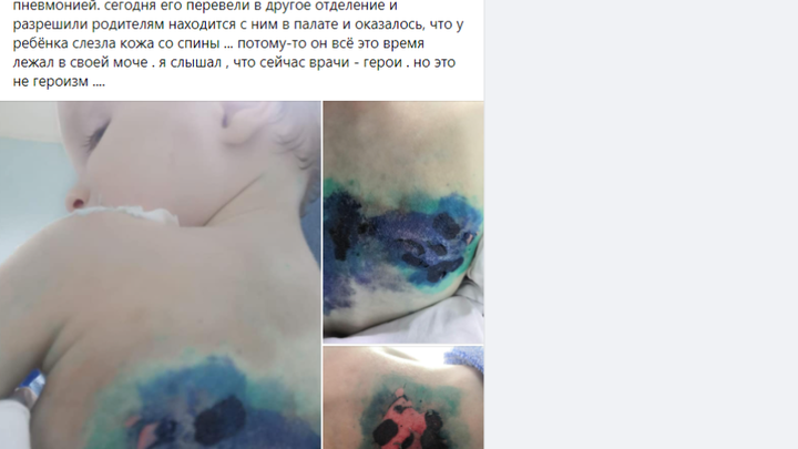 Ребенок в реанимации 4 дня лежал в своей моче: Следком начал проверку инцидента в больнице Анапы