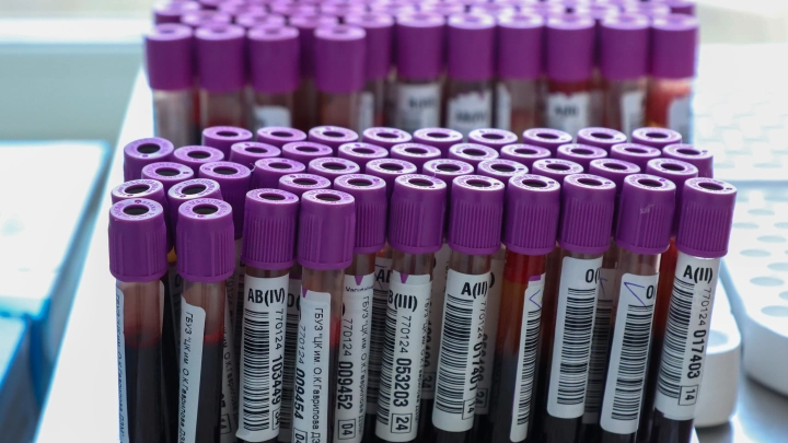 Фанат Эрика Давидыча на спор присел 2 тысячи раз: После отказали печень и почки