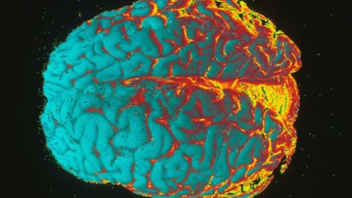 Учёные установили связь между размерами мозга человека и микробами в кишечнике