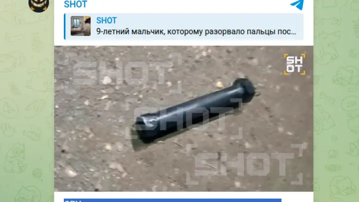 Дело не в 10 рублях: школьник потерял пальцы из-за СВУ в виде инструмента