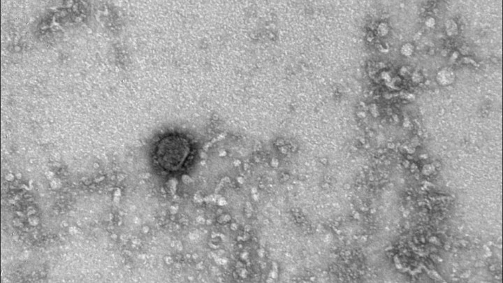 Ковид побеждает рак? Теоретически возможно - русский учёный