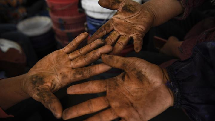 В пятом регионе Украины выявили вспышку болезни грязных рук