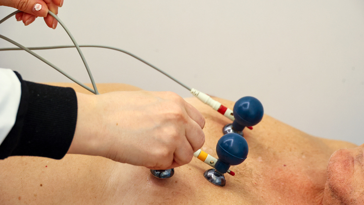 Врач-кардиолог предостерегла от физических нагрузок при обнаружении аритмии