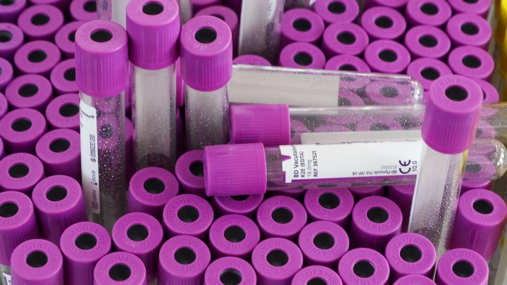 Показатели старения: врач назвала 6 признаков, которые можно увидеть в анализах