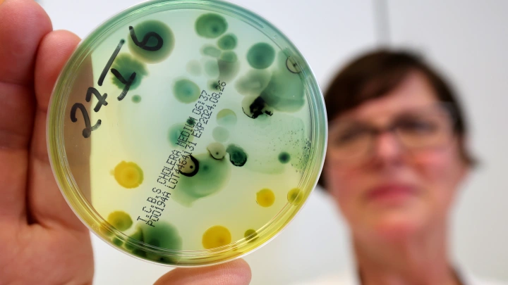 Выжить в Турции: Опасная бактерия косит туристов. Как сберечь себя? Советы врача