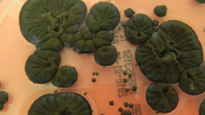 Прошло исследование: в Чернобыле обнаружили черный гриб, питающийся радиацией