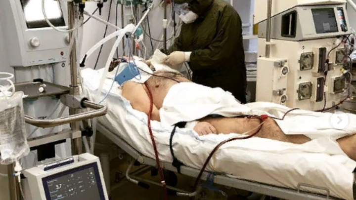 Два месяца в реанимации, 16 дней на ЭКМО: В Краснодаре врачи спасли больного с 95% поражением легких