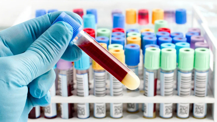 Холероподобный вибрион обнаружили в Мариуполе: О ситуации с заболеванием рассказал Роспотребнадзор