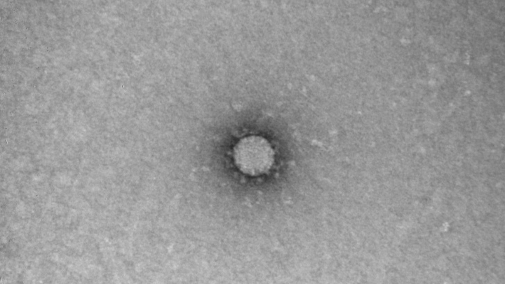 Сибирские учёные предложили бороться с коронавирусом при помощи наночастиц серебра