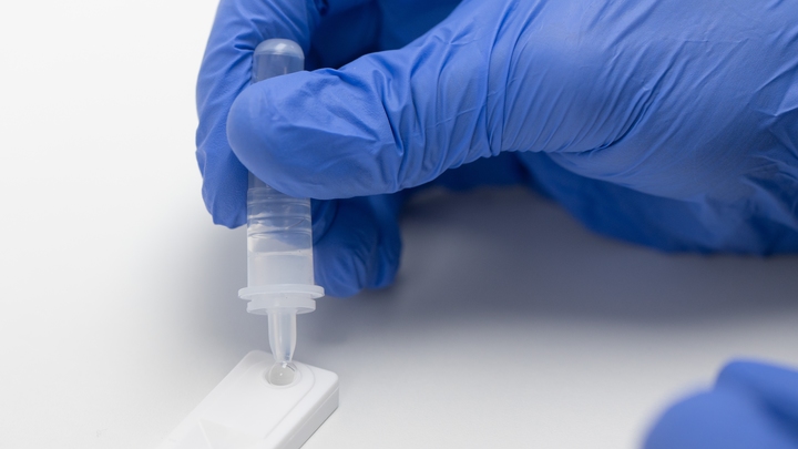 Результат за 72 часа: Завершены доклинические испытания кожного теста на иммунитет к COVID-19