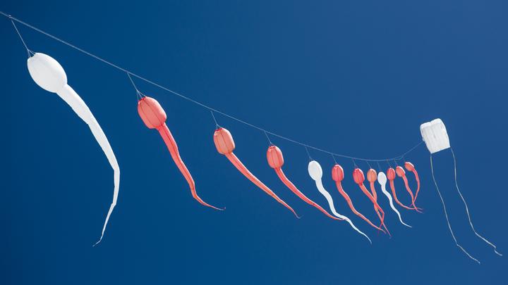 Тревожную проблему у мужчин в России озвучил эндокринолог: Ухудшение в два раза