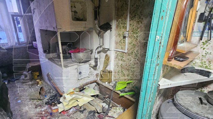 14-летней школьнице оторвало руки во время игры на телефоне из Иркутской области