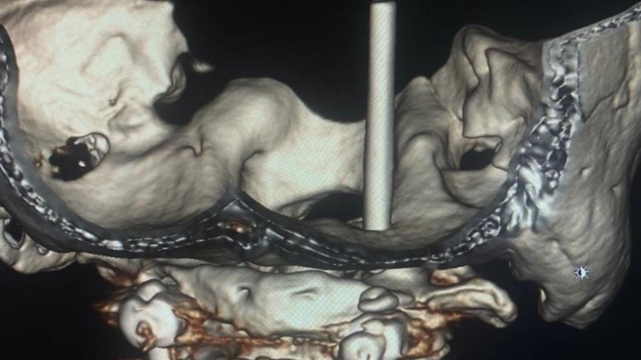 В Краснодаре пациент с редкой патологией едва не лишился зрения