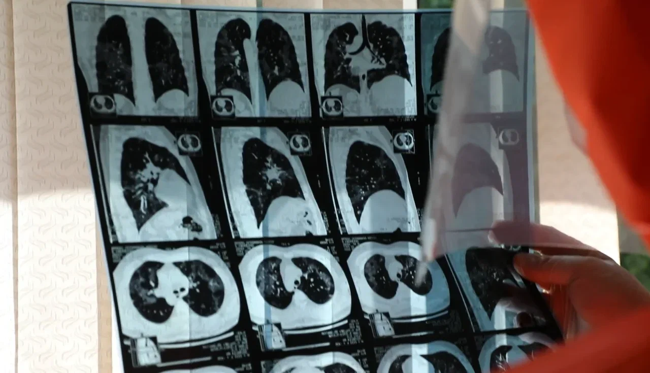 В Минздраве высказались о выплатах врачам негосударственных медучреждений