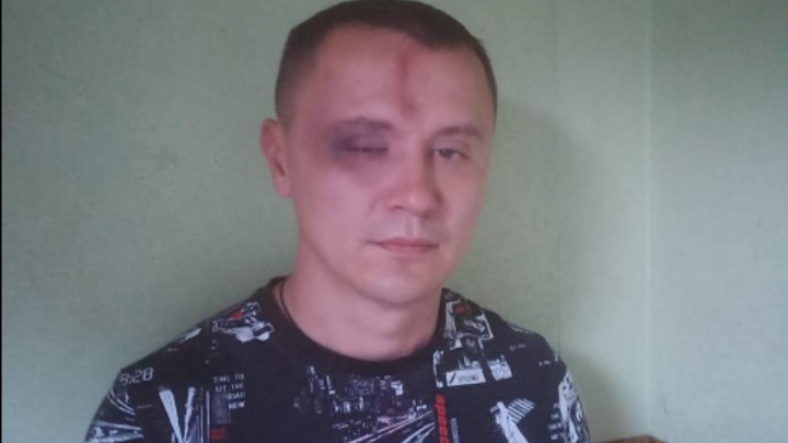 В Новосибирске полиция прокомментировала избиение дружинника