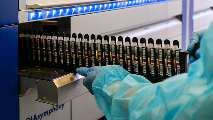 Частная лаборатория в Челябинске сообщила о цене теста на COVID-19