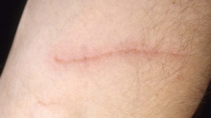 Профессор назвал гениальный антисептик. Стоит копейки