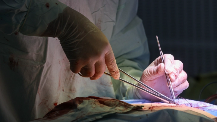 Ребенку из Сочи с разорванным хаски лицом провели первую 14-часовую пластику