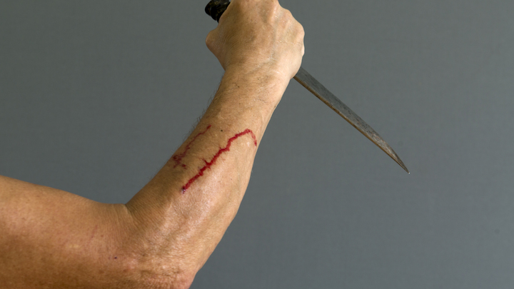 На Запорожье мужчина ударил собутыльника ножом в живот и скрылся с места преступления