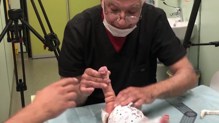 Один случай на 3,5 млрд: Русские врачи вылечили кроху с редкой патологией