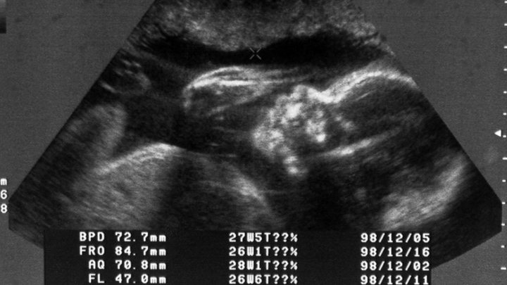 Новый бесчеловечный способ омоложения оценила Шафран: Это не шуточки