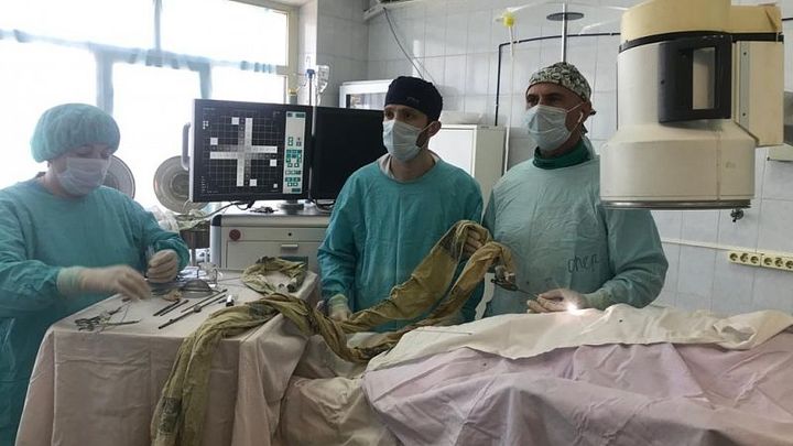 В Новороссийске мужчине удалили 6-сантиметровый коралловидный камень