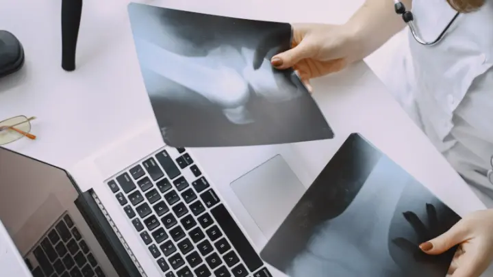 В Склифе показали на рентгене самые неожиданные находки в телах пациентов