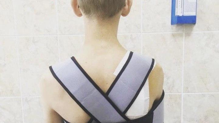 В Краснодаре врачи БСМП спасли горбатого мальчика