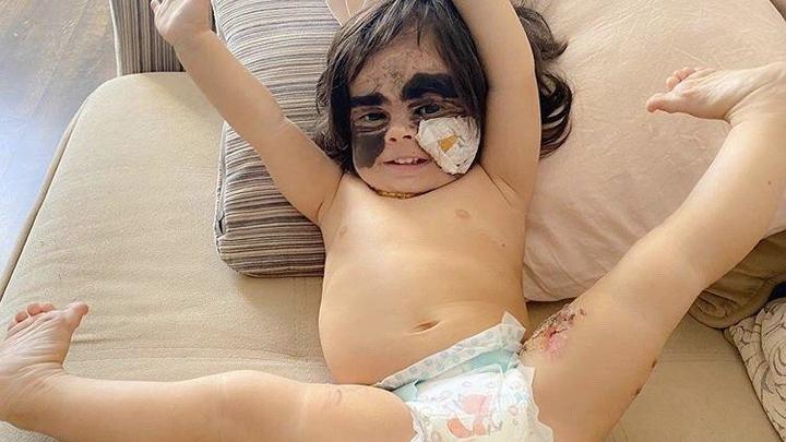 Мама американки Луны Феннер объяснила, почему она решила лечить свою дочь в России