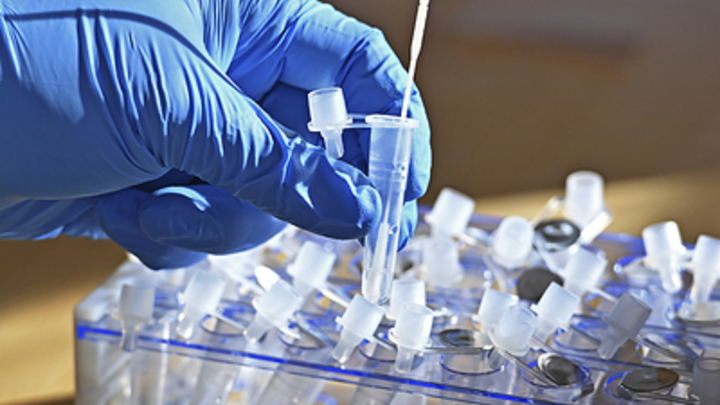 Какие болезни после COVID останутся навсегда: Врач перечислила четыре угрозы