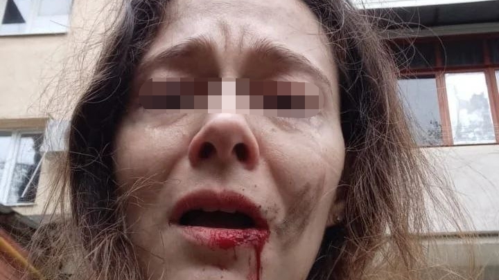 В Сочи пенсионер избил палкой по голове прохожую, которая вычёсывала собаку