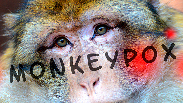 Оспу обезьян запланировали в 2020 году. Опубликованы планы убийства миллионов